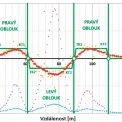 Obr. 3 – Identifikace prvků trajektorie pomocí směrových úhlů φi a jejich odchylek Δφi
